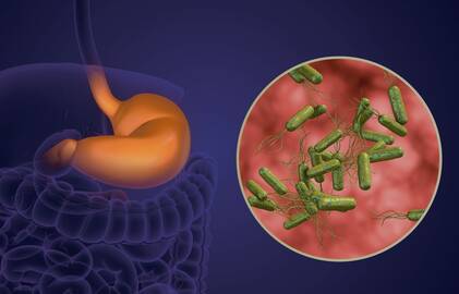 Pavojinga: H. Pylori bakterija kolonizuoja žmogaus skrandį ir atlieka pagrindinį vaidmenį daugelio virškinamojo trakto ligų išsivystyme.