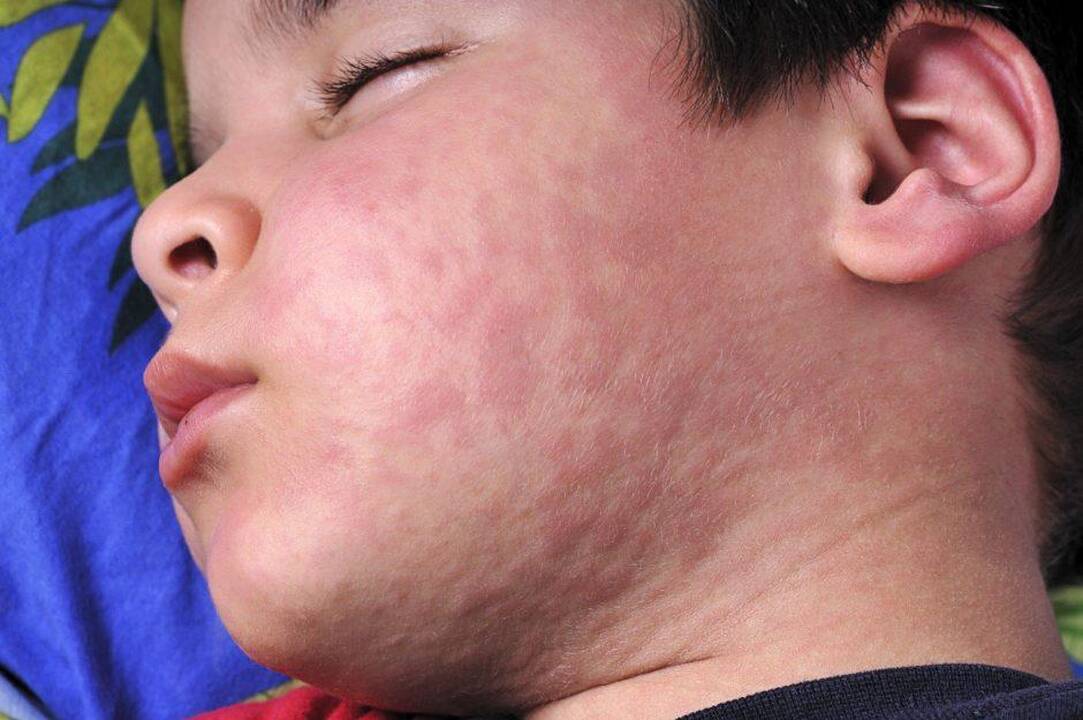 Asociatyvi nuotr.
