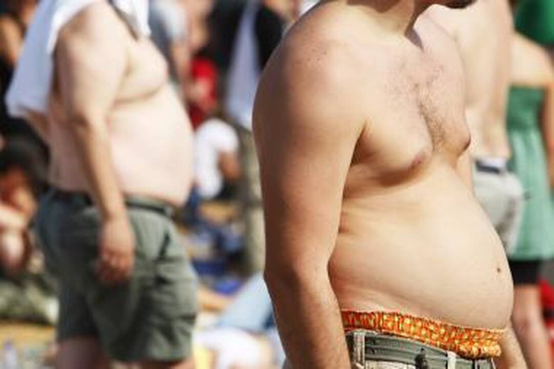 Gydant nutukimą padidėja kaulų lūžių rizika