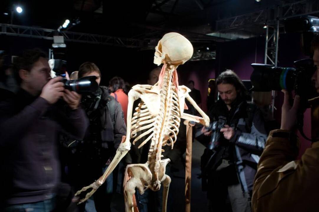 Prieštaringai vertinamoje parodoje – žmonių kūnai ir jų dalys