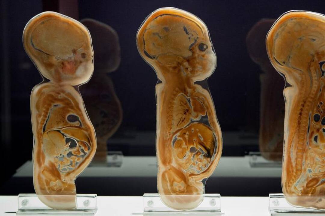 Prieštaringai vertinamoje parodoje – žmonių kūnai ir jų dalys