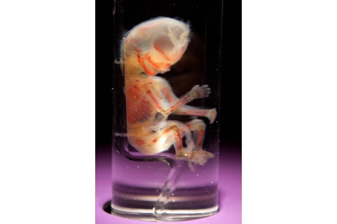 Prieštaringai vertinamoje parodoje – žmonių kūnai ir jų dalys