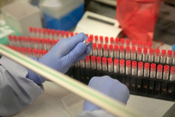 Laboratorijos vadovas: reagentų siunta dar nepasiekė Lietuvos, tiekimas trūkinėja