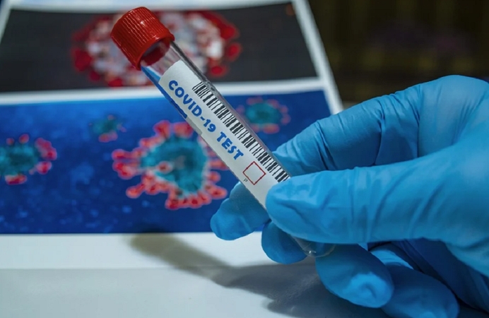 Indija tapo antra labiausiai pandemijos paveikta šalimi po JAV