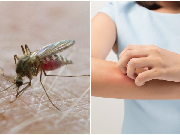 Specialistės patarimai: kaip vasarą ištverti uodų kaimynystę?