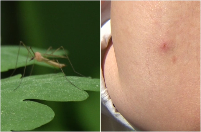 Naudingi patarimai: kaip apsisaugoti nuo uodų?